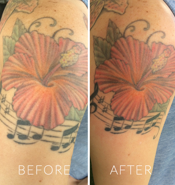 Before & After Tatul Use
